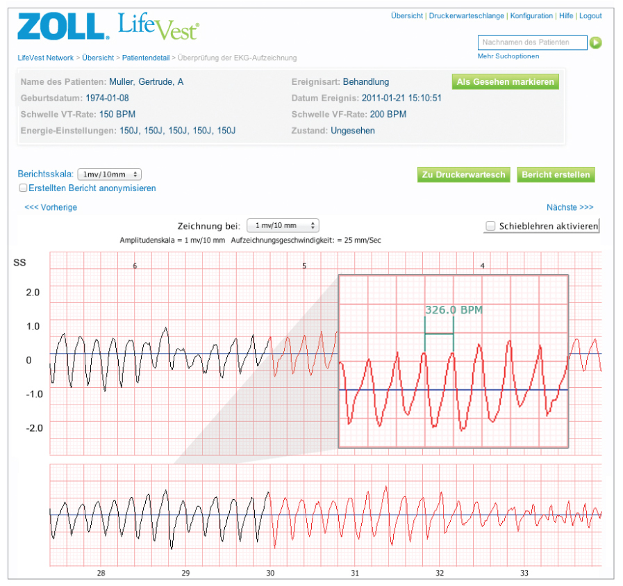 LifeVest Network | ZOLL LifeVest