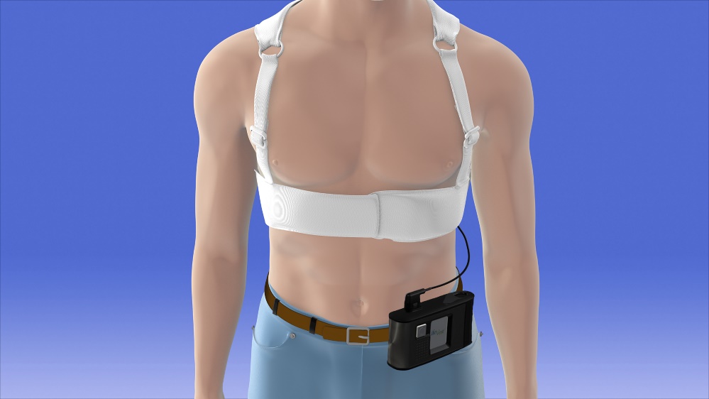 Illustration of the ZOLL LifeVest wearable defibrillator for heart patients