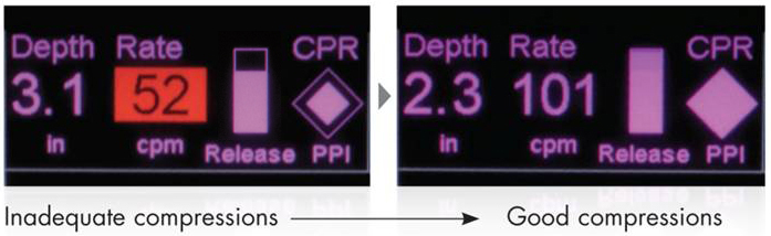 CPR Feedback